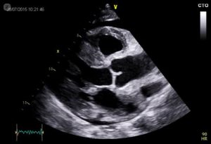 echocardiography sialkot
