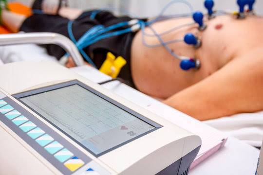 ecg